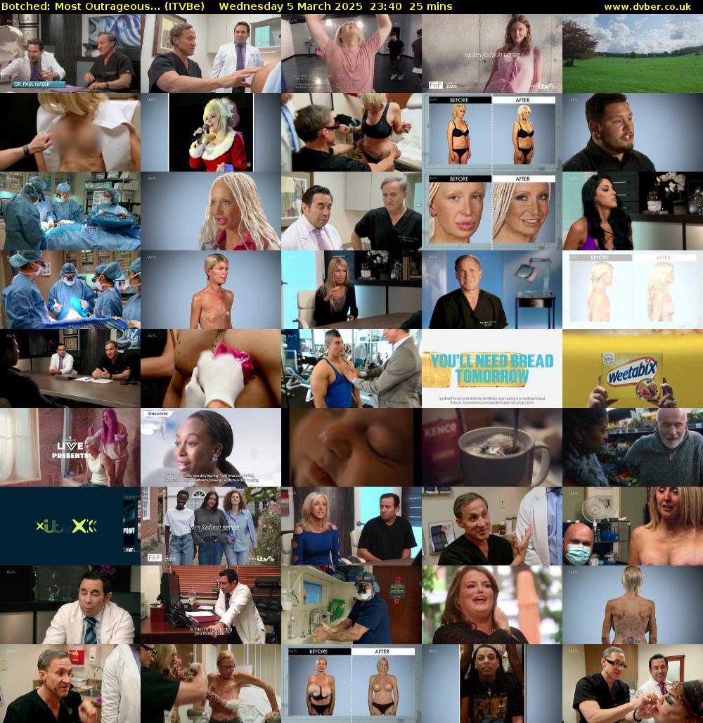 Botched: Most Outrageous... (ITVBe) Wednesday 5 March 2025 23:40 - 00:05