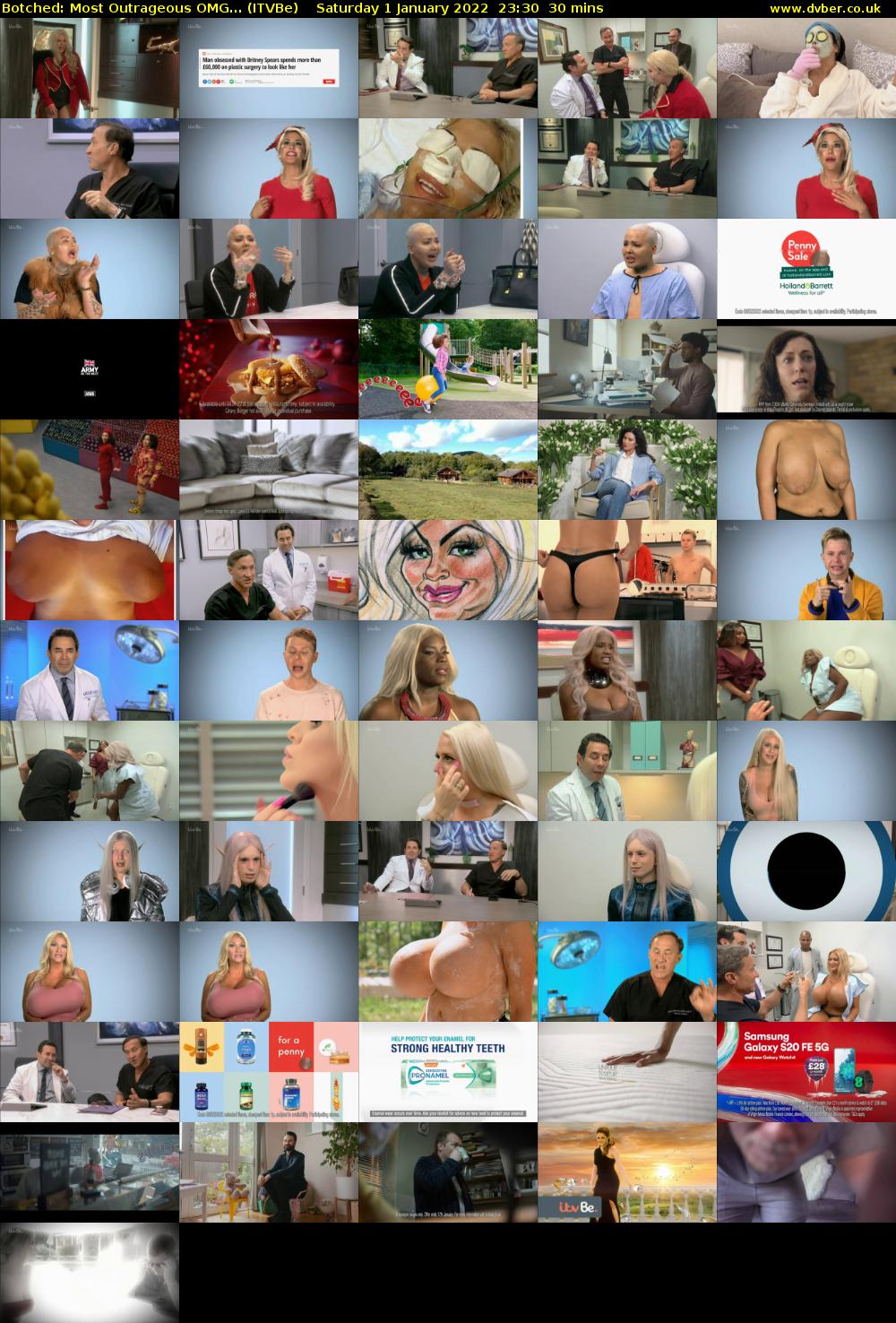 Botched: Most Outrageous OMG... (ITVBe) Saturday 1 January 2022 23:30 - 00:00