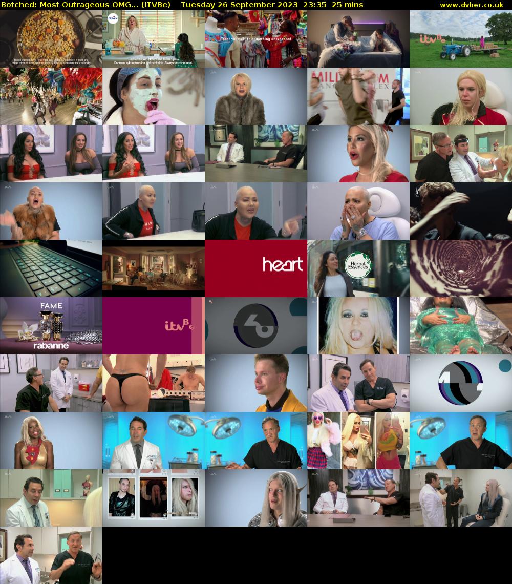 Botched: Most Outrageous OMG... (ITVBe) Tuesday 26 September 2023 23:35 - 00:00