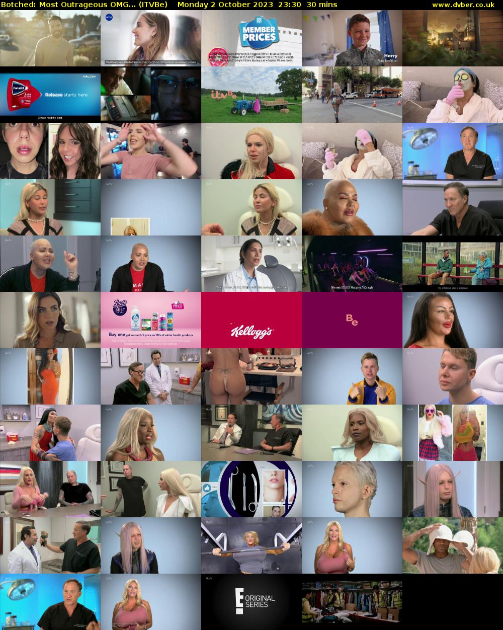 Botched: Most Outrageous OMG... (ITVBe) Monday 2 October 2023 23:30 - 00:00