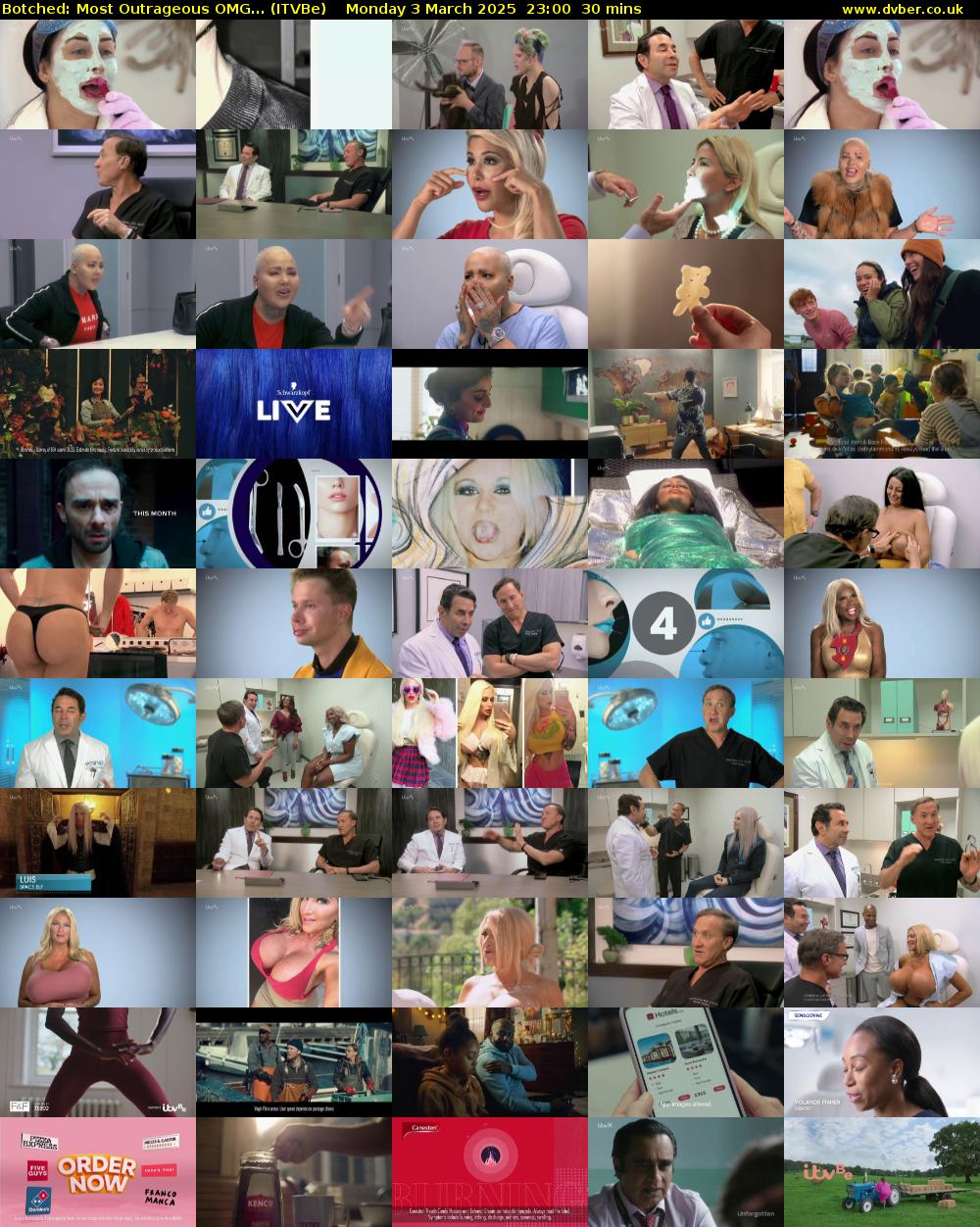 Botched: Most Outrageous OMG... (ITVBe) Monday 3 March 2025 23:00 - 23:30