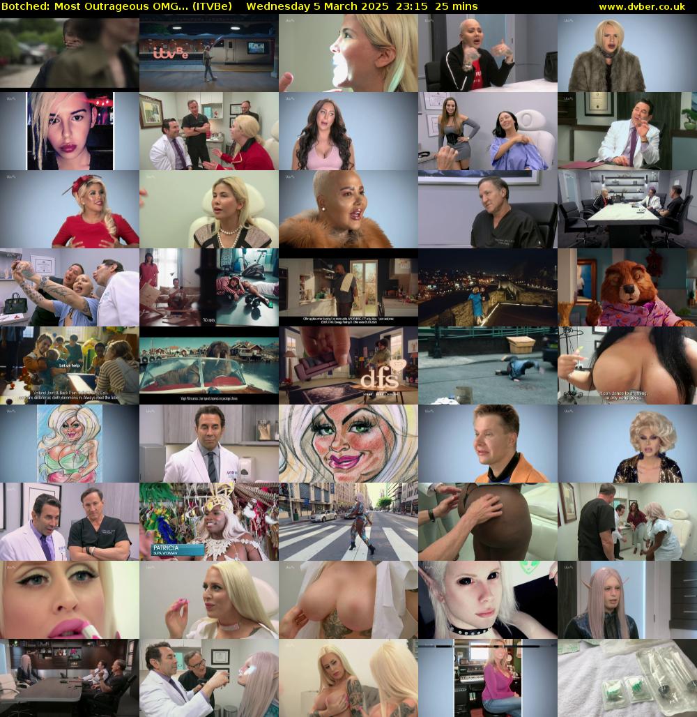 Botched: Most Outrageous OMG... (ITVBe) Wednesday 5 March 2025 23:15 - 23:40