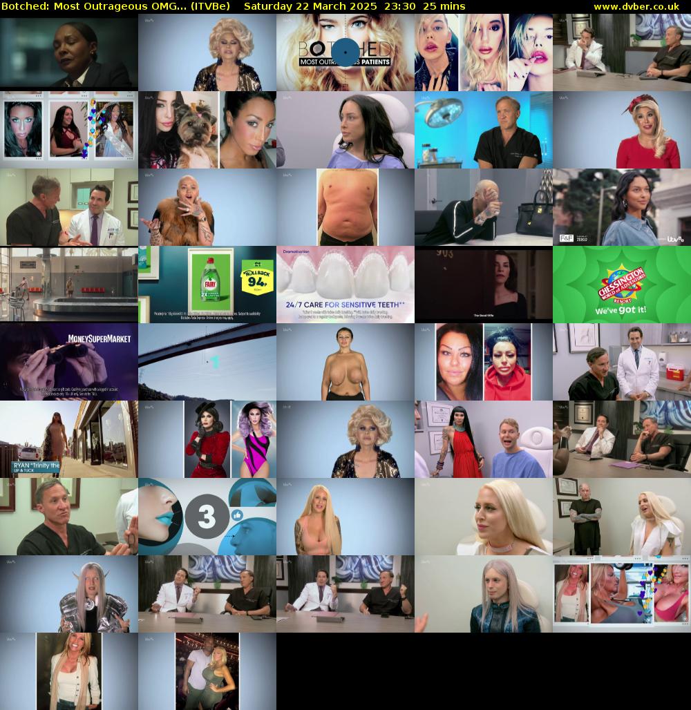 Botched: Most Outrageous OMG... (ITVBe) Saturday 22 March 2025 23:30 - 23:55