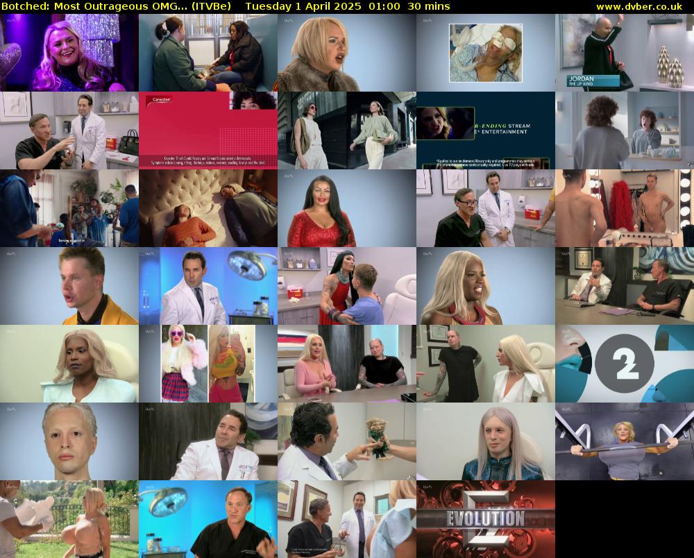 Botched: Most Outrageous OMG... (ITVBe) Tuesday 1 April 2025 01:00 - 01:30
