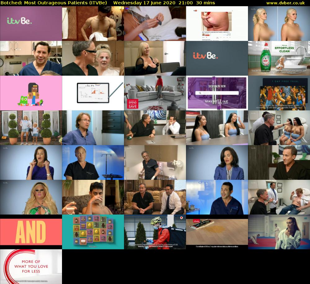 Botched: Most Outrageous Patients (ITVBe) Wednesday 17 June 2020 21:00 - 21:30