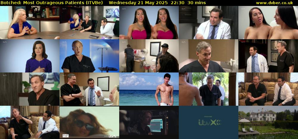 Botched: Most Outrageous Patients (ITVBe) Wednesday 21 May 2025 22:30 - 23:00