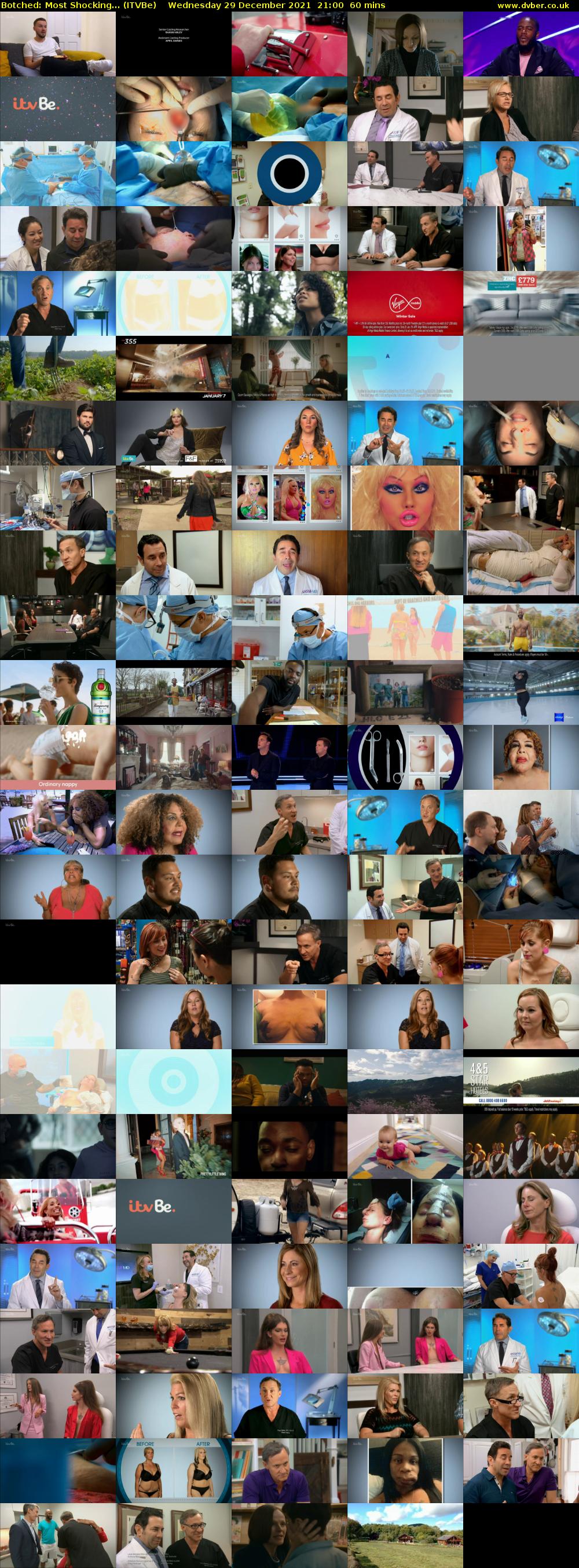 Botched: Most Shocking... (ITVBe) Wednesday 29 December 2021 21:00 - 22:00