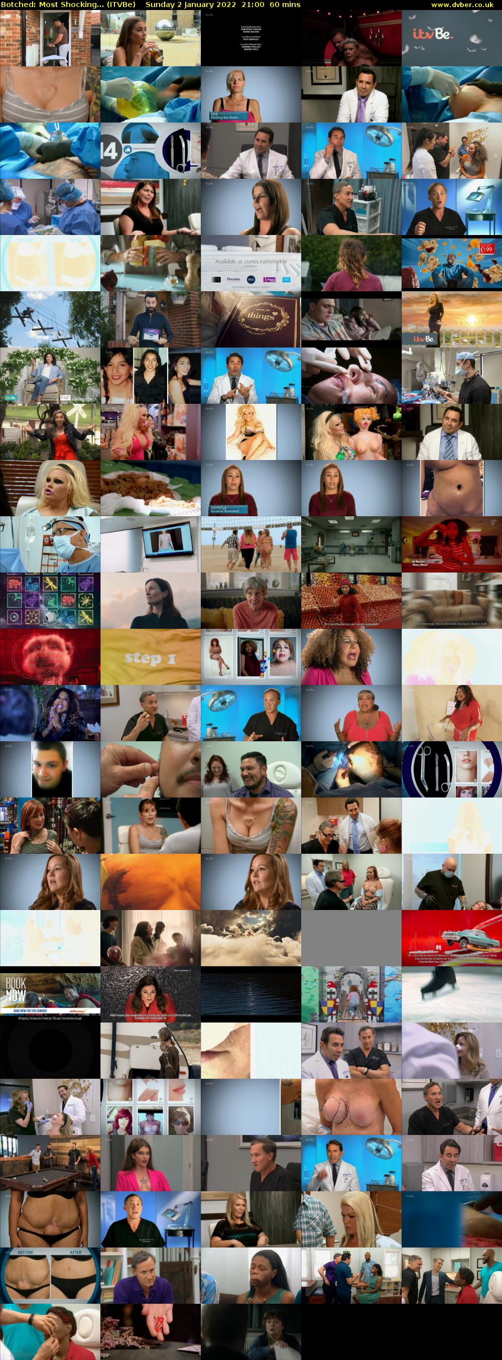 Botched: Most Shocking... (ITVBe) Sunday 2 January 2022 21:00 - 22:00