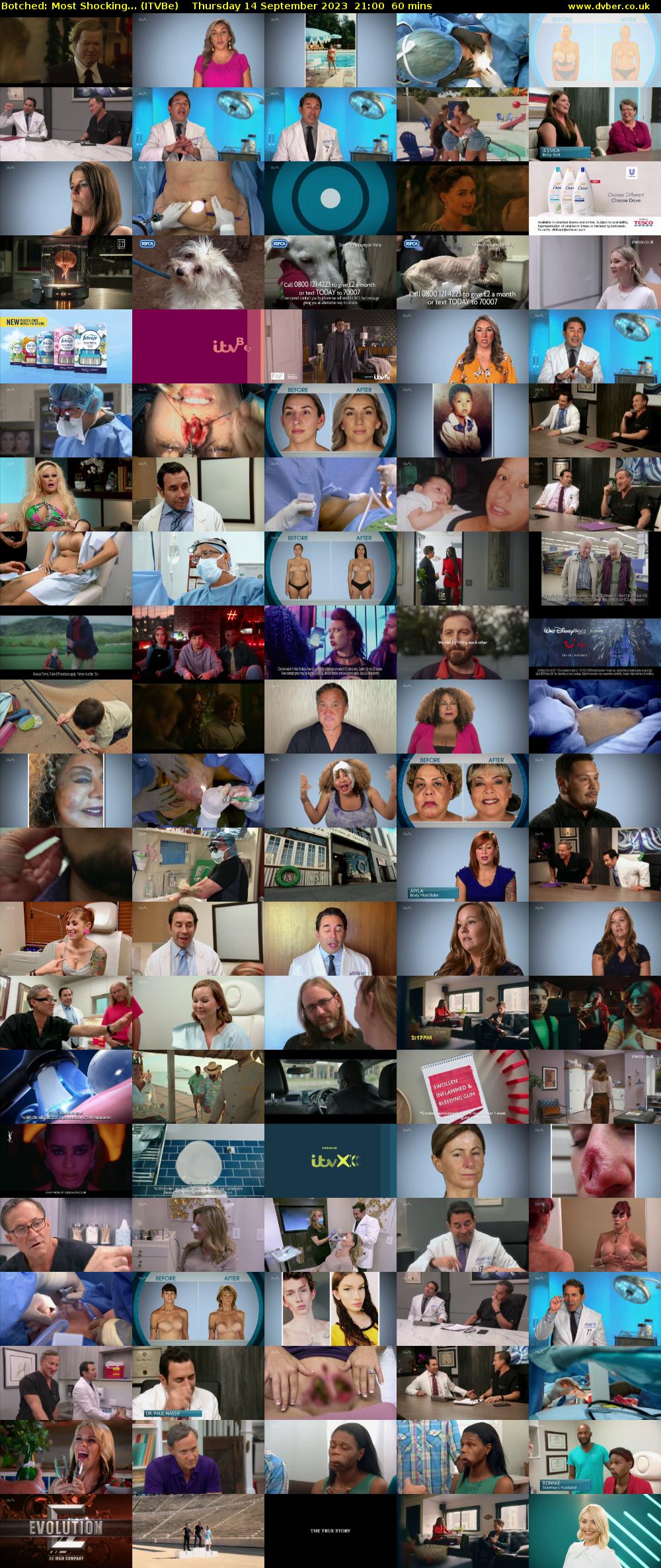 Botched: Most Shocking... (ITVBe) Thursday 14 September 2023 21:00 - 22:00