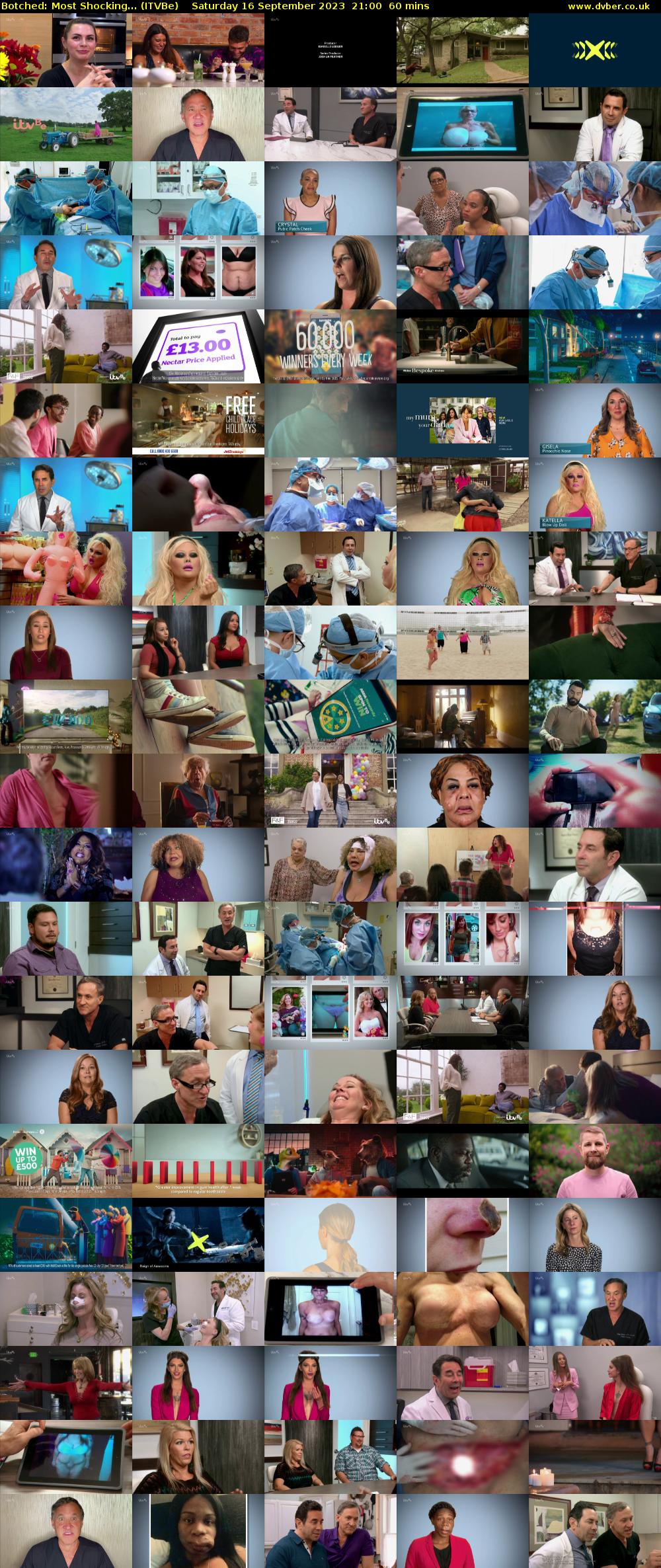 Botched: Most Shocking... (ITVBe) Saturday 16 September 2023 21:00 - 22:00
