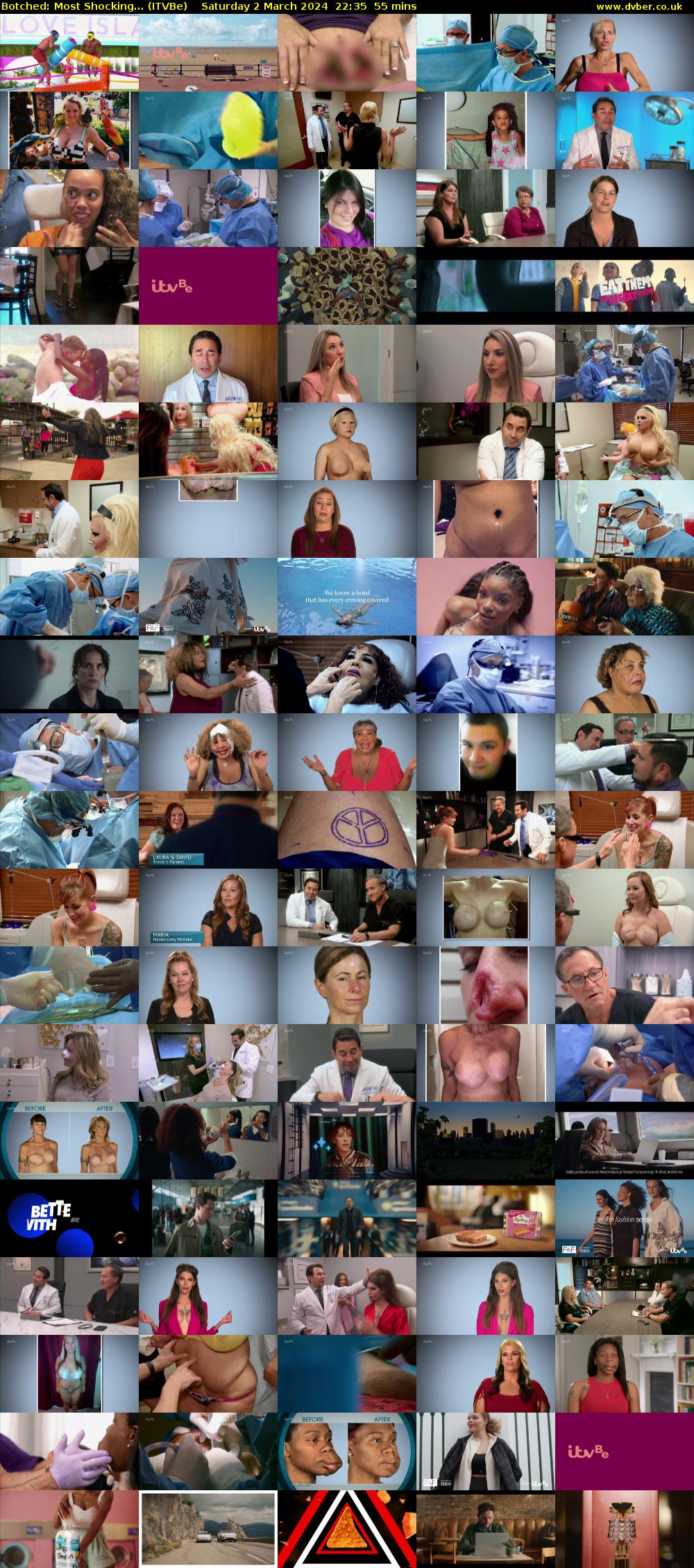 Botched: Most Shocking... (ITVBe) Saturday 2 March 2024 22:35 - 23:30