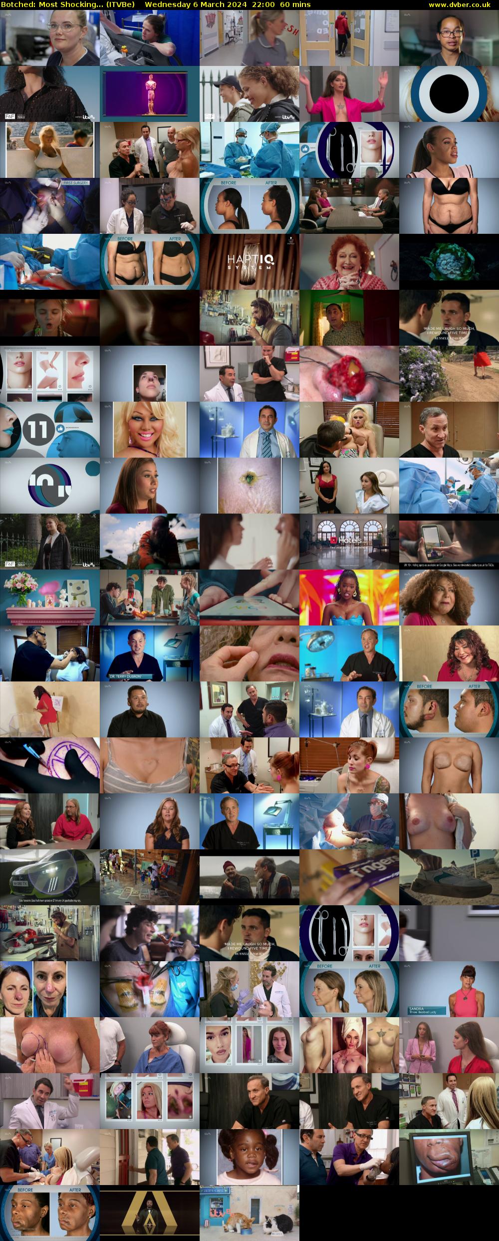 Botched: Most Shocking... (ITVBe) Wednesday 6 March 2024 22:00 - 23:00