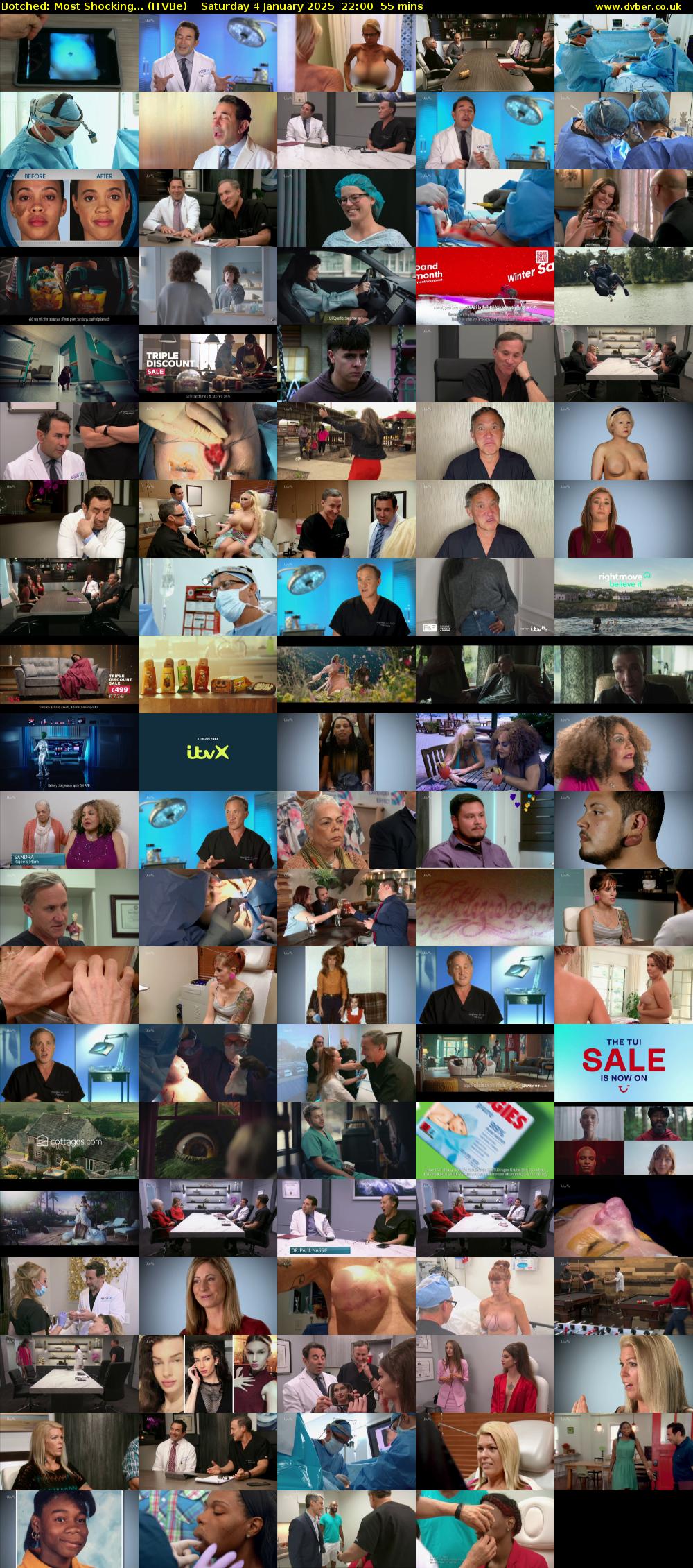 Botched: Most Shocking... (ITVBe) Saturday 4 January 2025 22:00 - 22:55