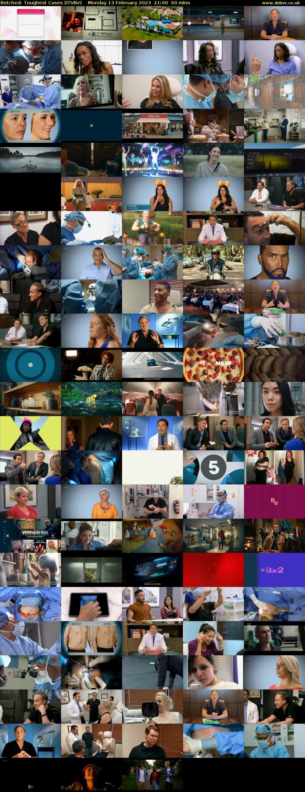 Botched: Toughest Cases (ITVBe) Monday 13 February 2023 21:00 - 22:00
