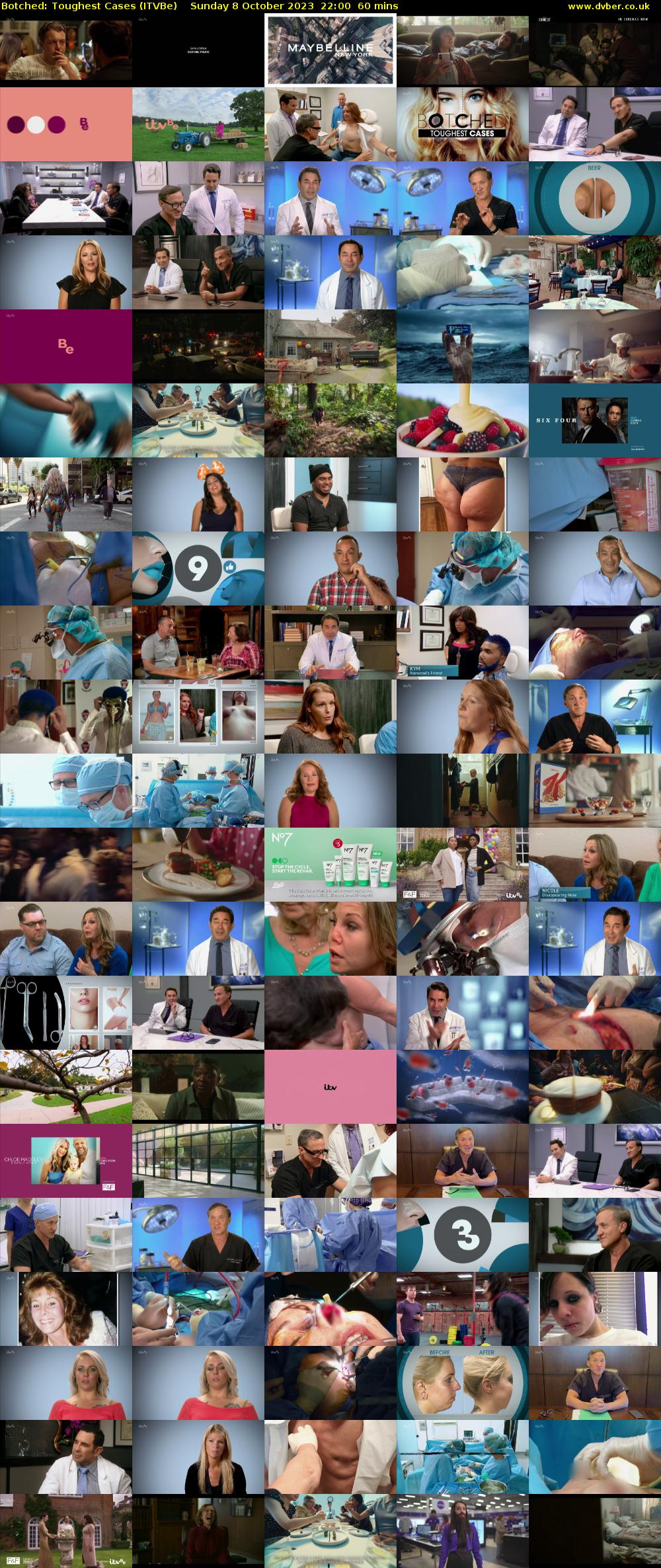 Botched: Toughest Cases (ITVBe) Sunday 8 October 2023 22:00 - 23:00