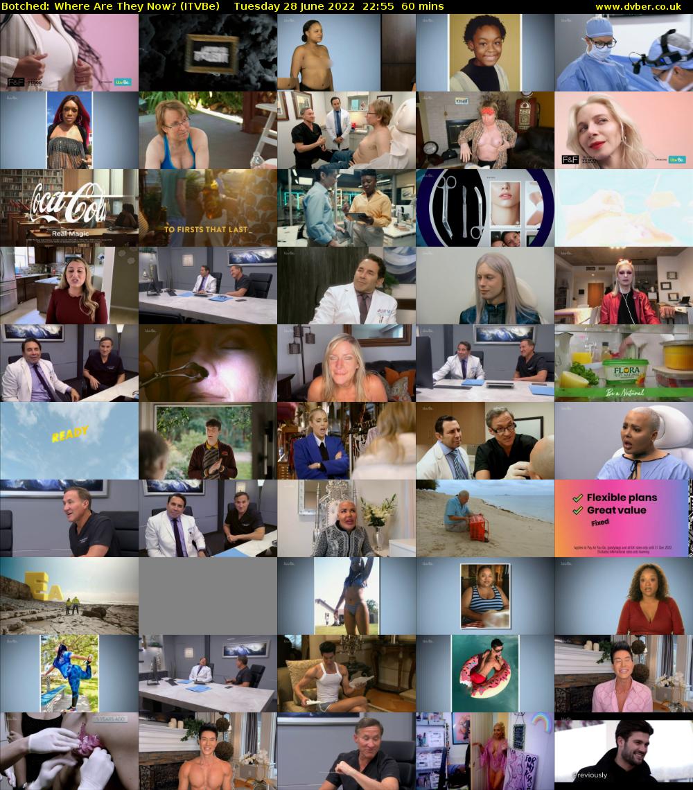 Botched: Where Are They Now? (ITVBe) Tuesday 28 June 2022 22:55 - 23:55