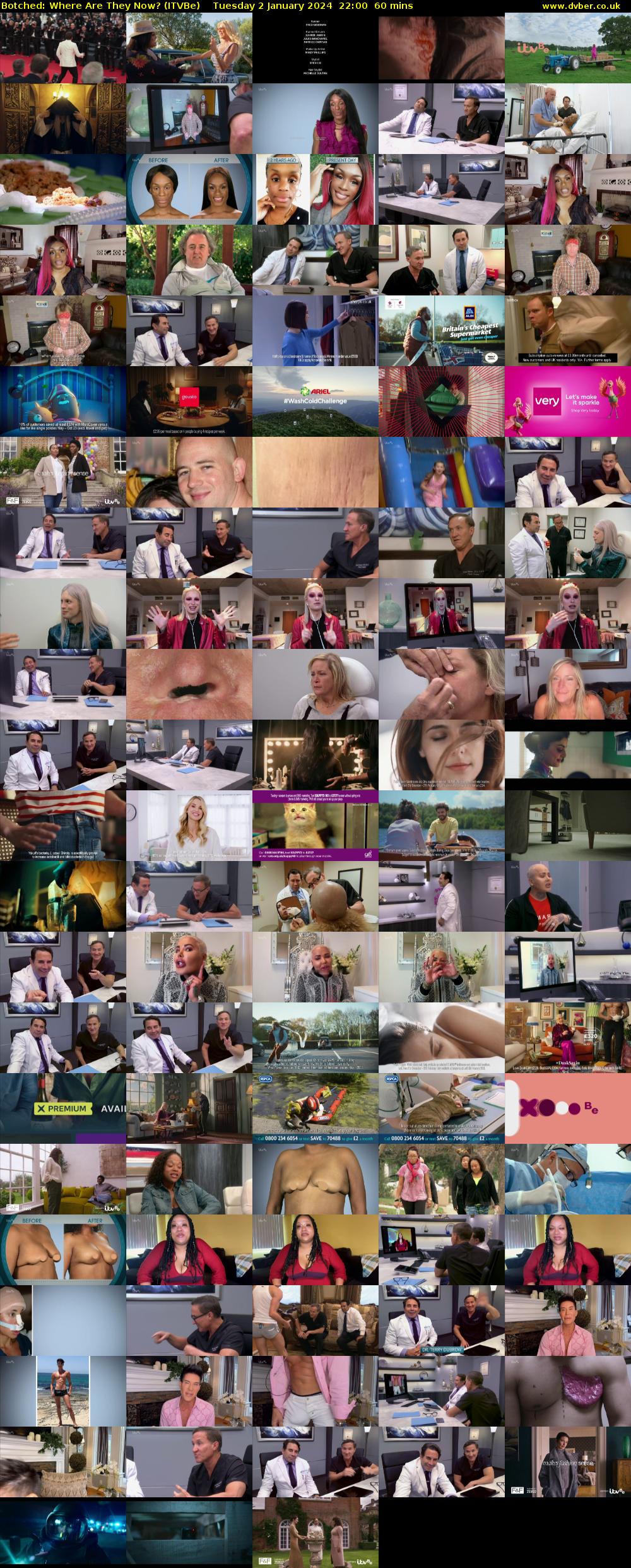 Botched: Where Are They Now? (ITVBe) Tuesday 2 January 2024 22:00 - 23:00