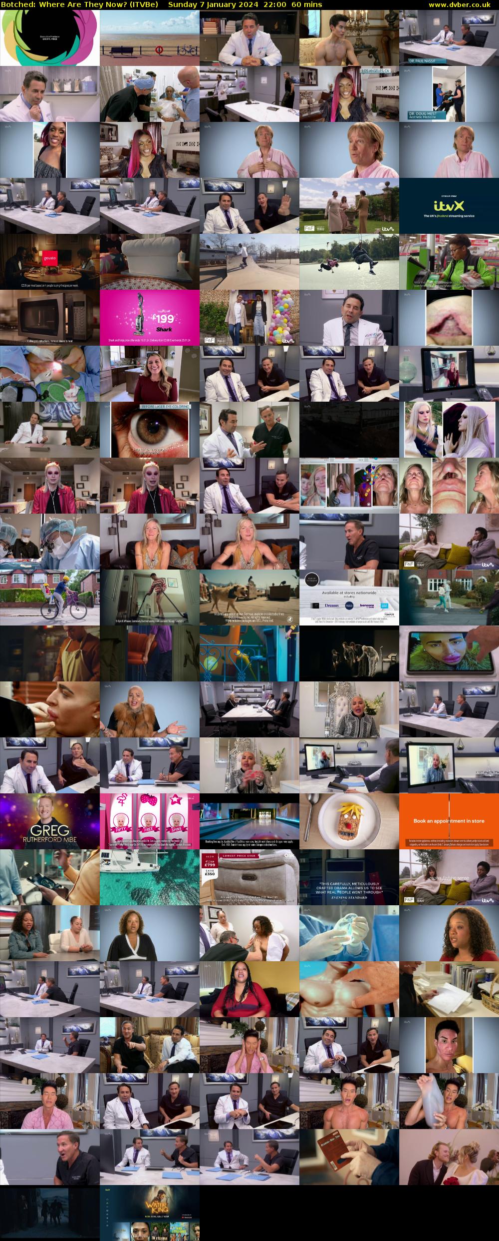 Botched: Where Are They Now? (ITVBe) Sunday 7 January 2024 22:00 - 23:00