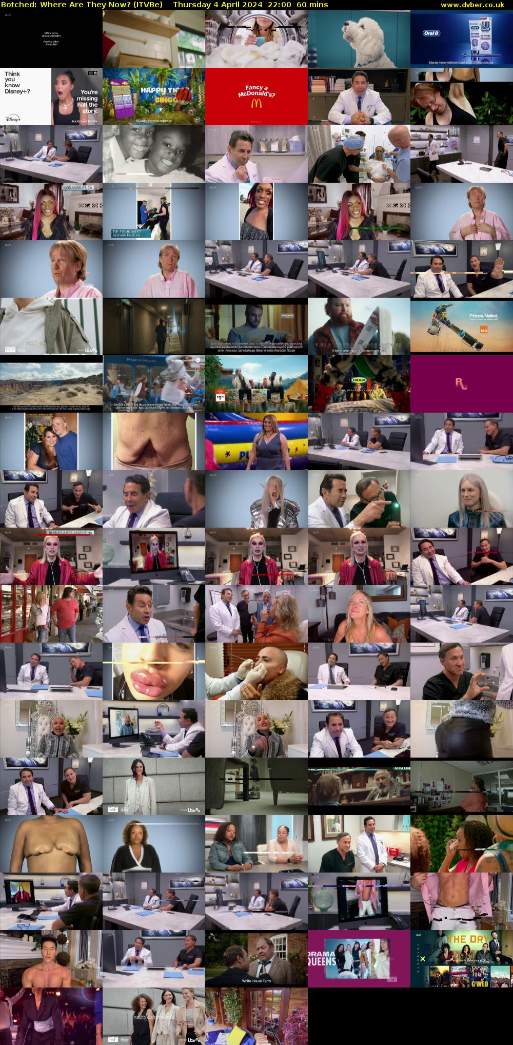 Botched: Where Are They Now? (ITVBe) Thursday 4 April 2024 22:00 - 23:00