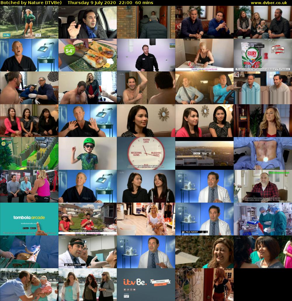 Botched by Nature (ITVBe) Thursday 9 July 2020 22:00 - 23:00
