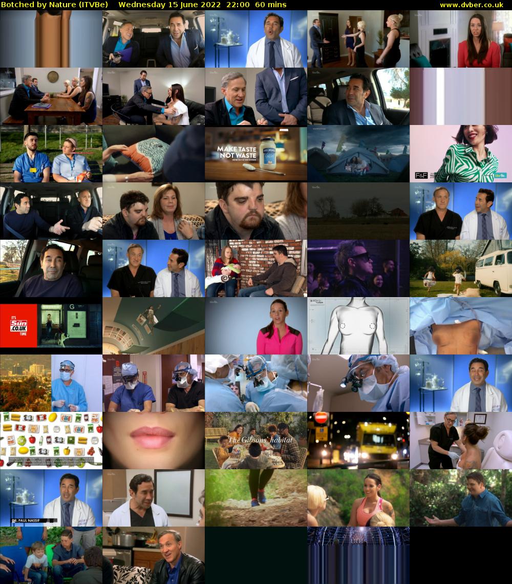 Botched by Nature (ITVBe) Wednesday 15 June 2022 22:00 - 23:00