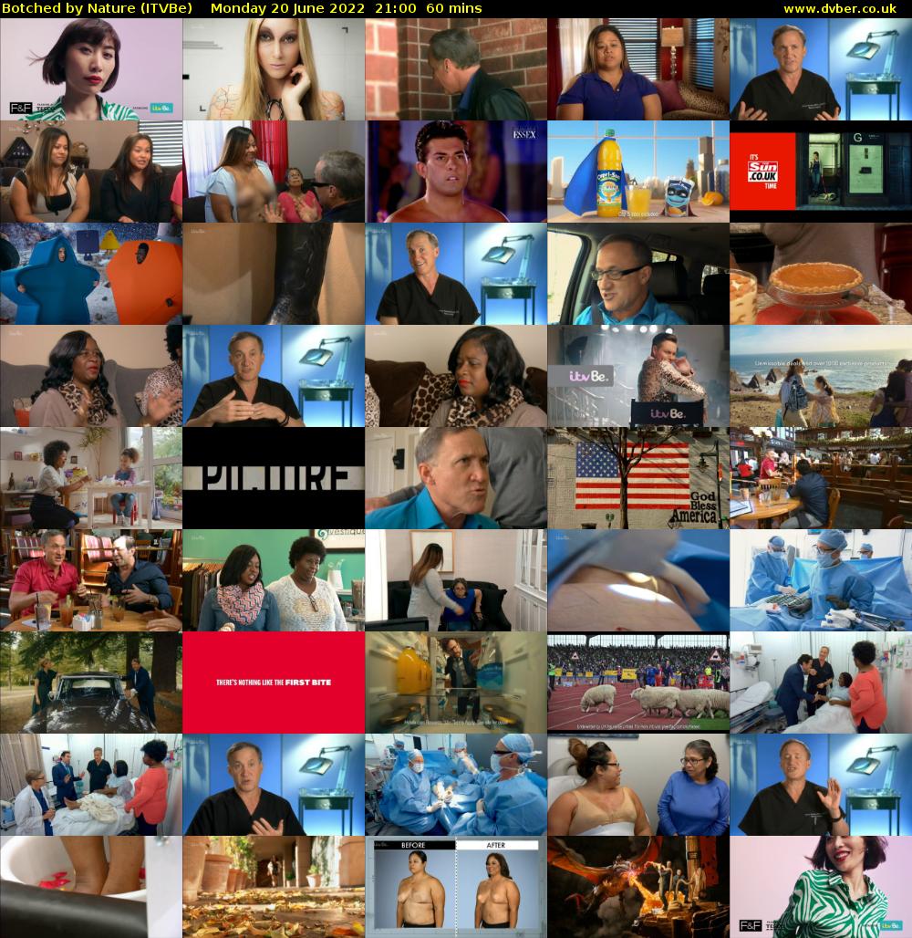 Botched by Nature (ITVBe) Monday 20 June 2022 21:00 - 22:00