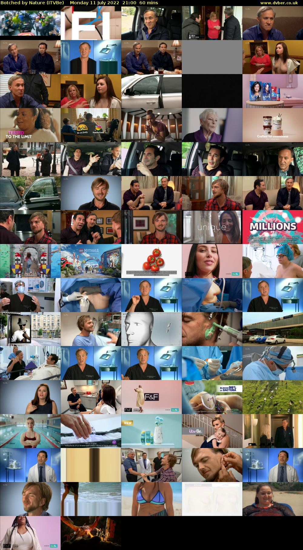 Botched by Nature (ITVBe) Monday 11 July 2022 21:00 - 22:00