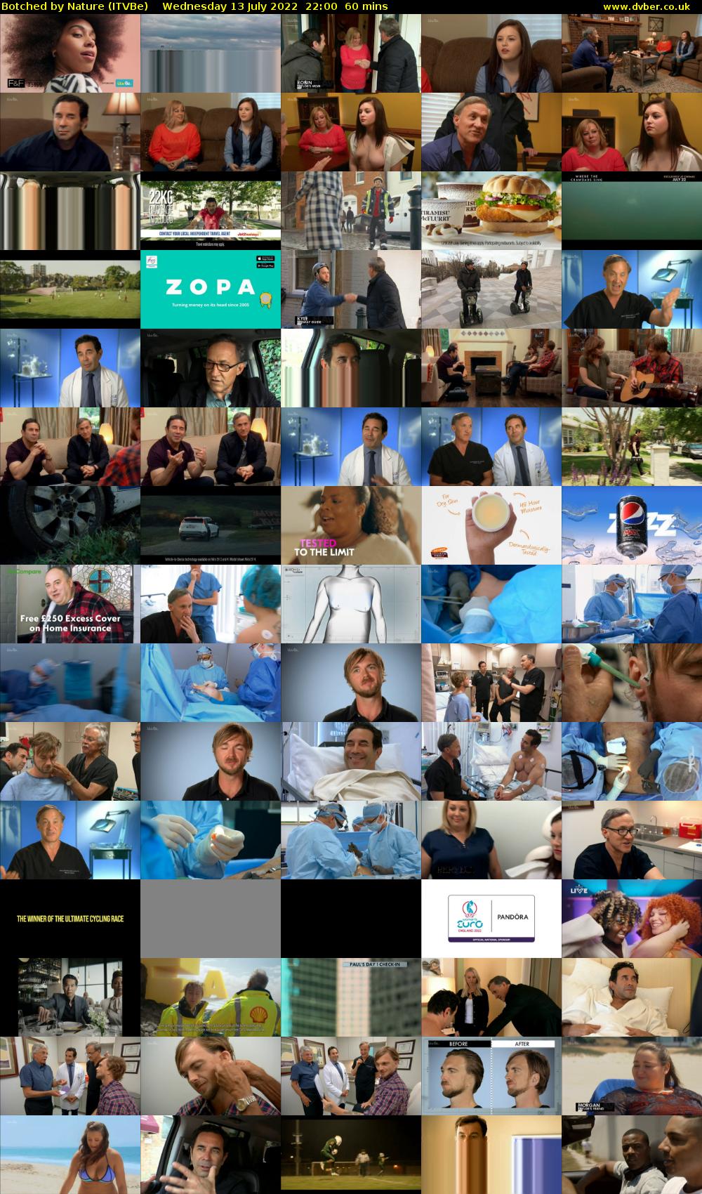 Botched by Nature (ITVBe) Wednesday 13 July 2022 22:00 - 23:00