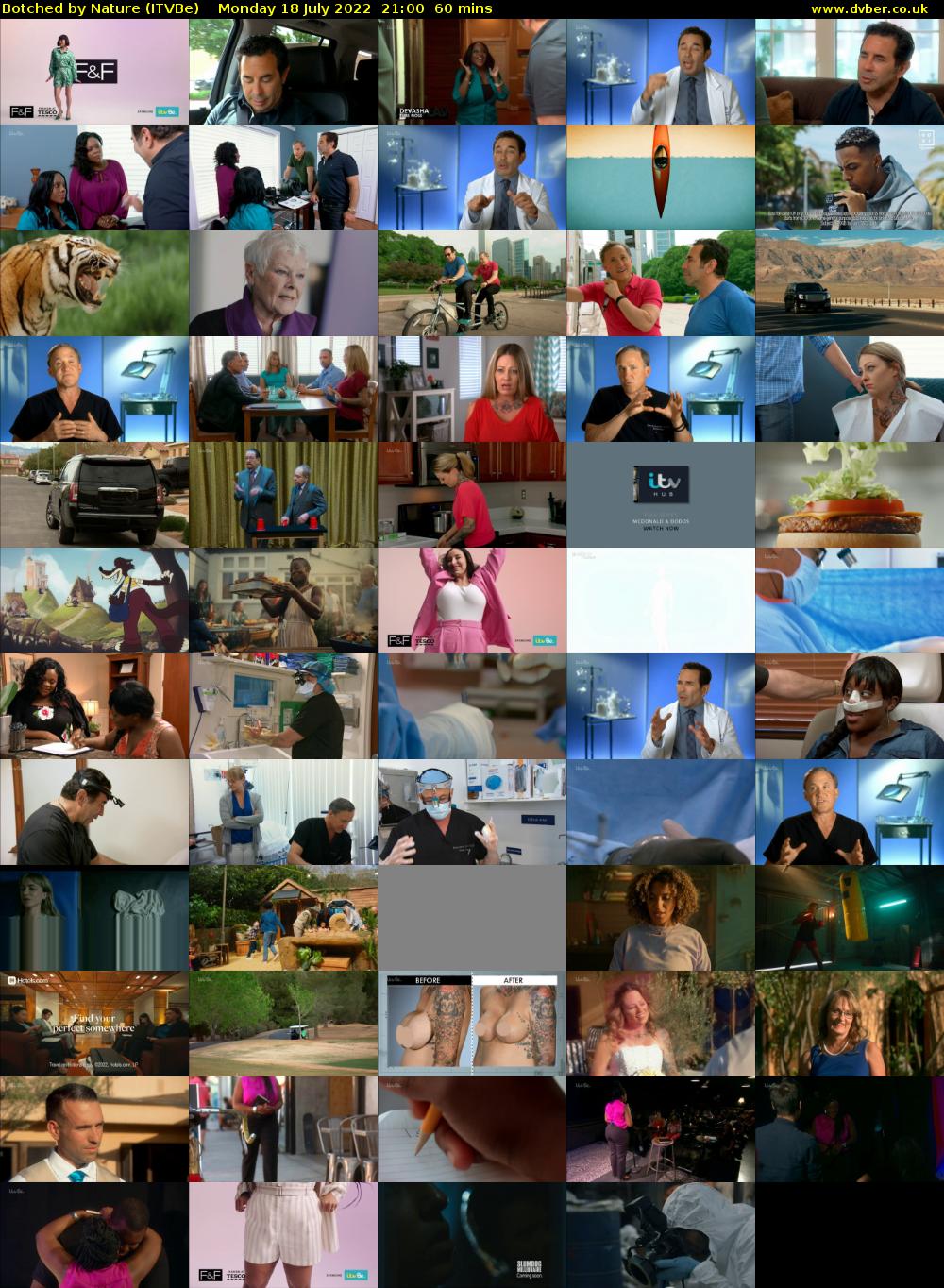 Botched by Nature (ITVBe) Monday 18 July 2022 21:00 - 22:00