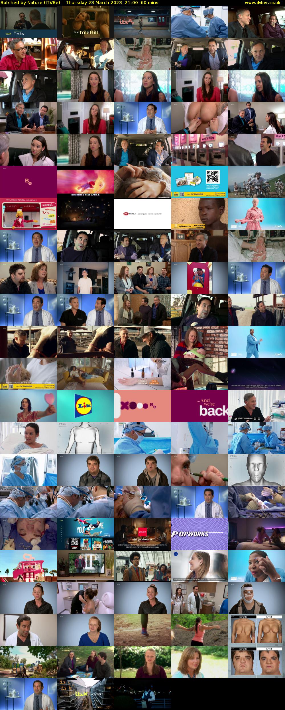Botched by Nature (ITVBe) Thursday 23 March 2023 21:00 - 22:00