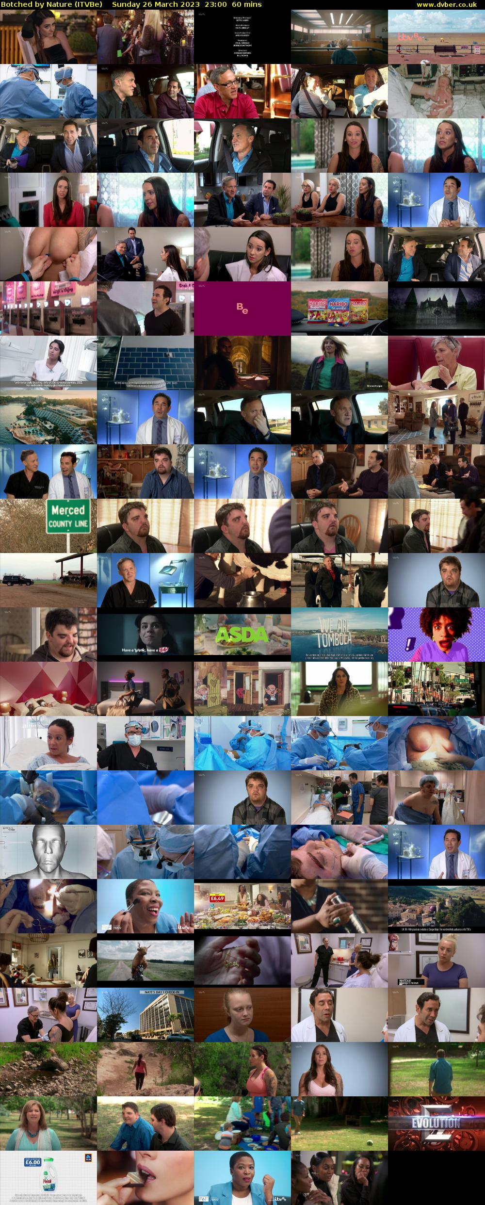 Botched by Nature (ITVBe) Sunday 26 March 2023 23:00 - 00:00