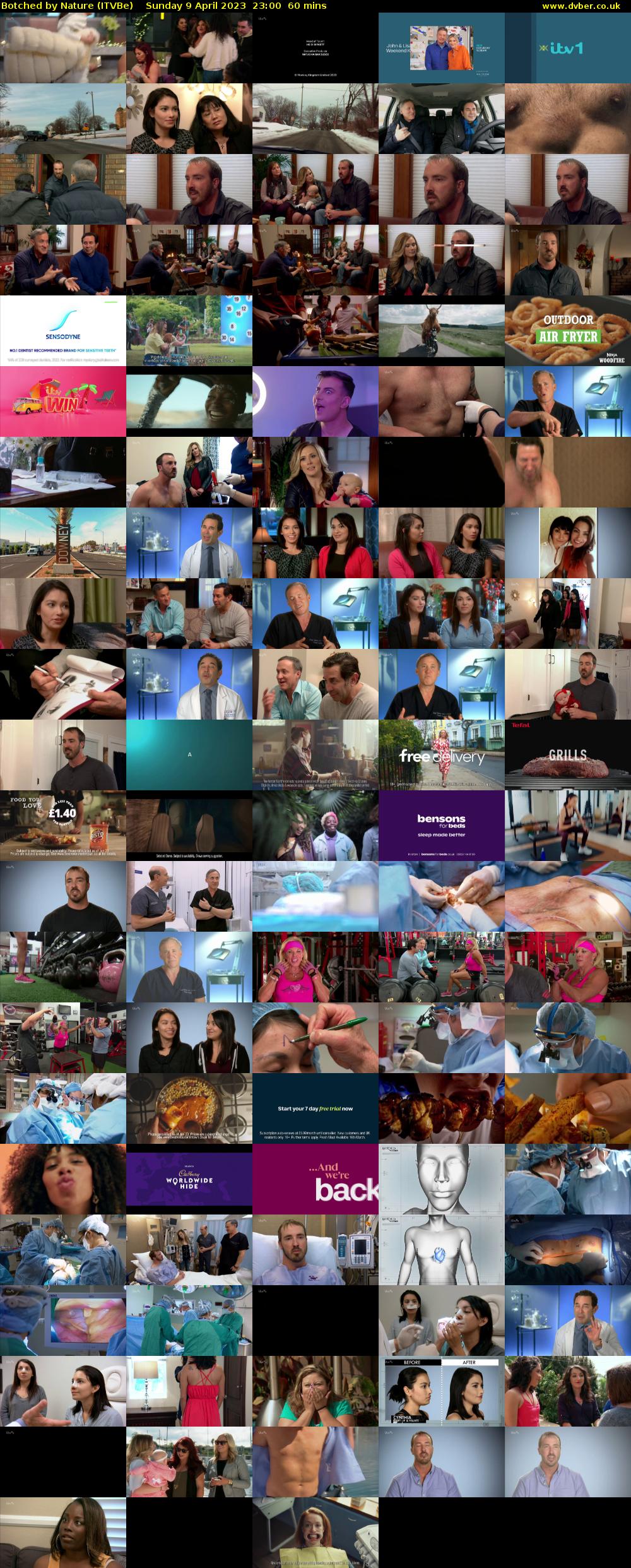 Botched by Nature (ITVBe) Sunday 9 April 2023 23:00 - 00:00