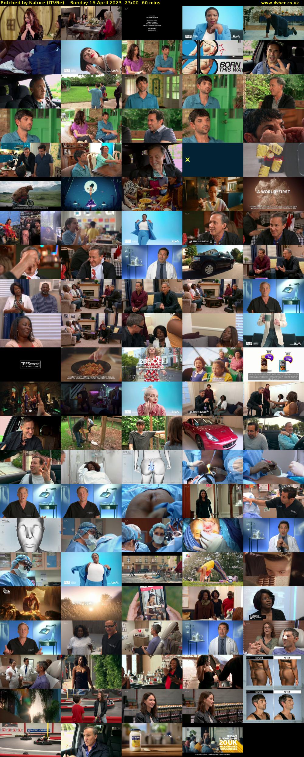 Botched by Nature (ITVBe) Sunday 16 April 2023 23:00 - 00:00