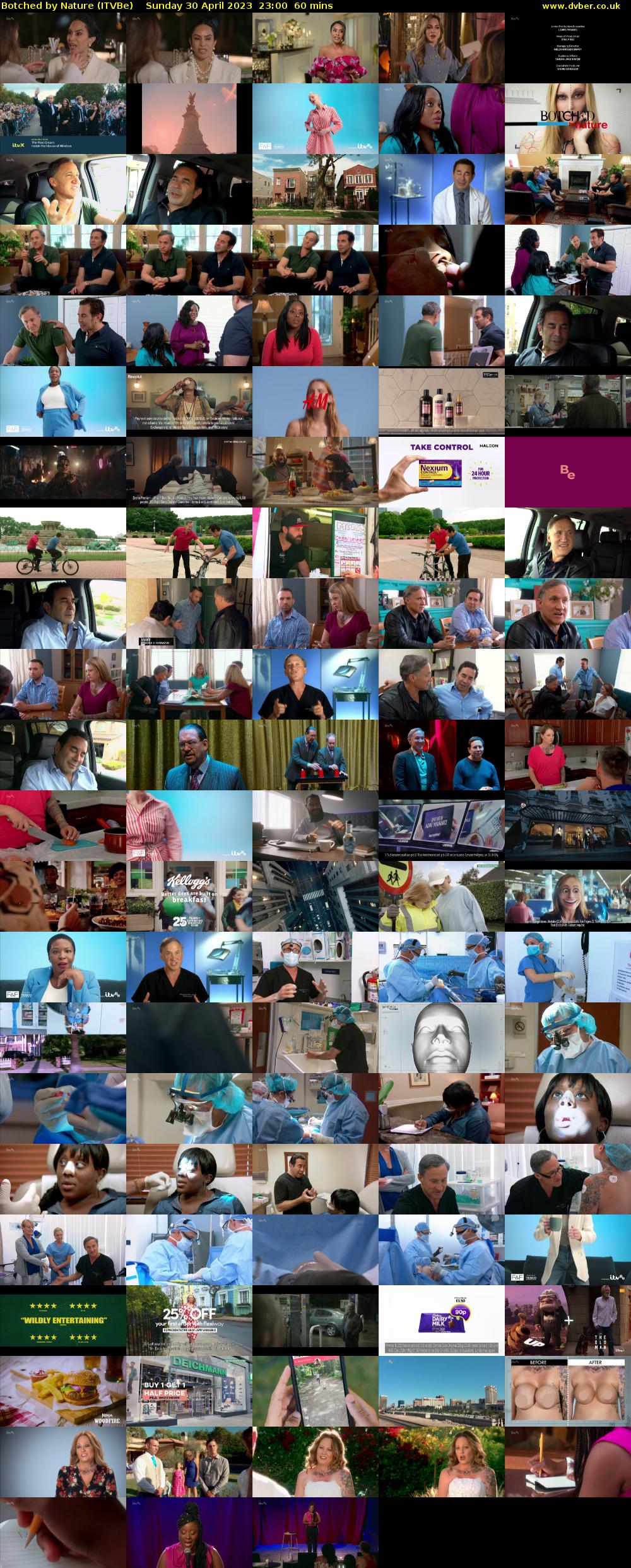 Botched by Nature (ITVBe) Sunday 30 April 2023 23:00 - 00:00