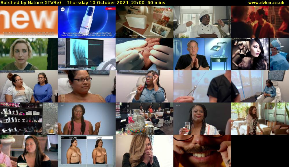 Botched by Nature (ITVBe) Thursday 10 October 2024 22:00 - 23:00