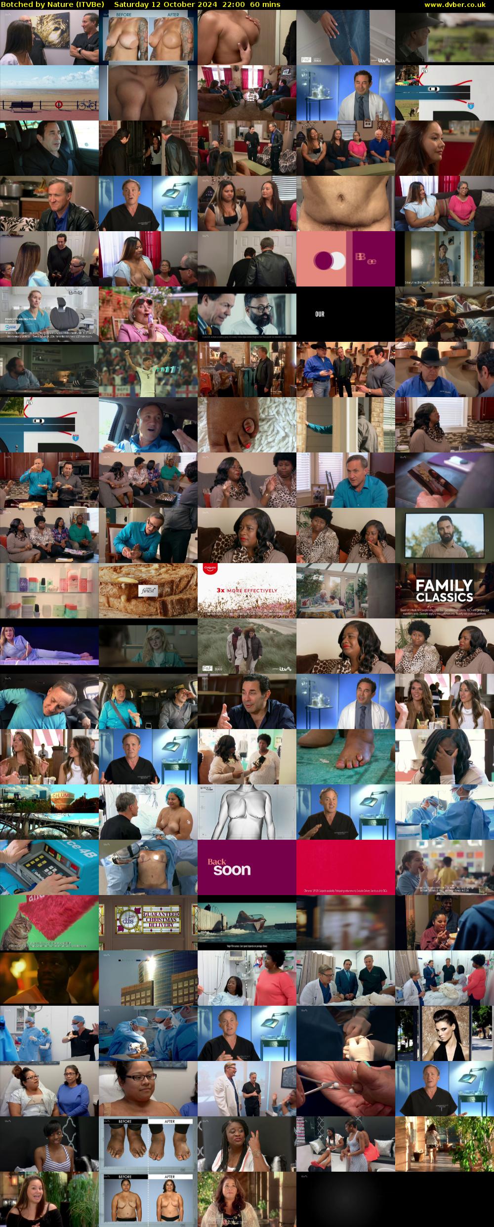 Botched by Nature (ITVBe) Saturday 12 October 2024 22:00 - 23:00