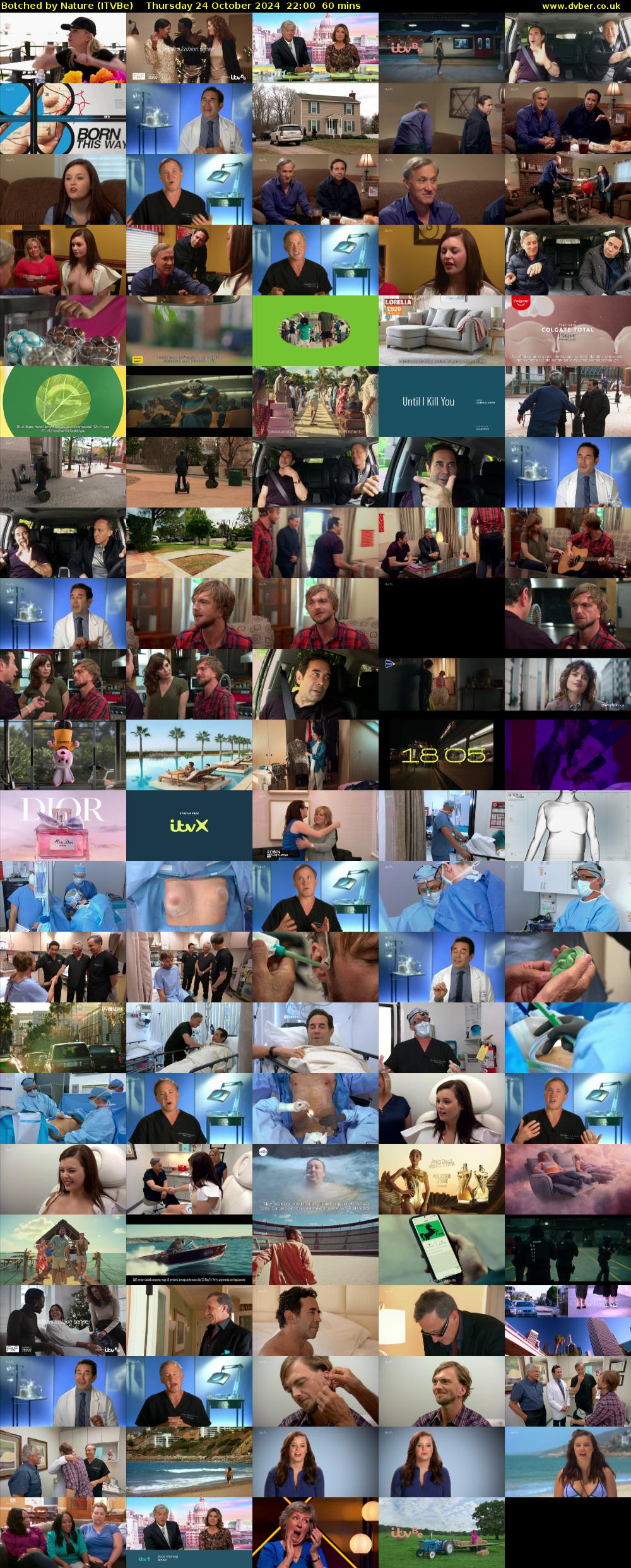 Botched by Nature (ITVBe) Thursday 24 October 2024 22:00 - 23:00