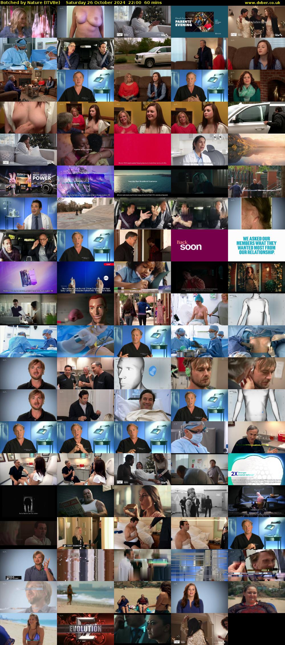 Botched by Nature (ITVBe) Saturday 26 October 2024 22:00 - 23:00