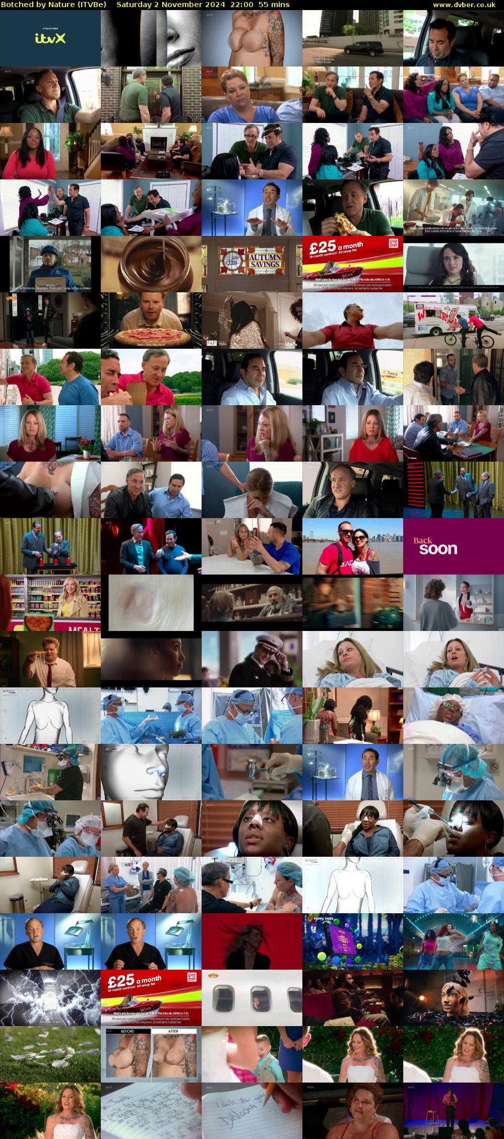 Botched by Nature (ITVBe) Saturday 2 November 2024 22:00 - 22:55