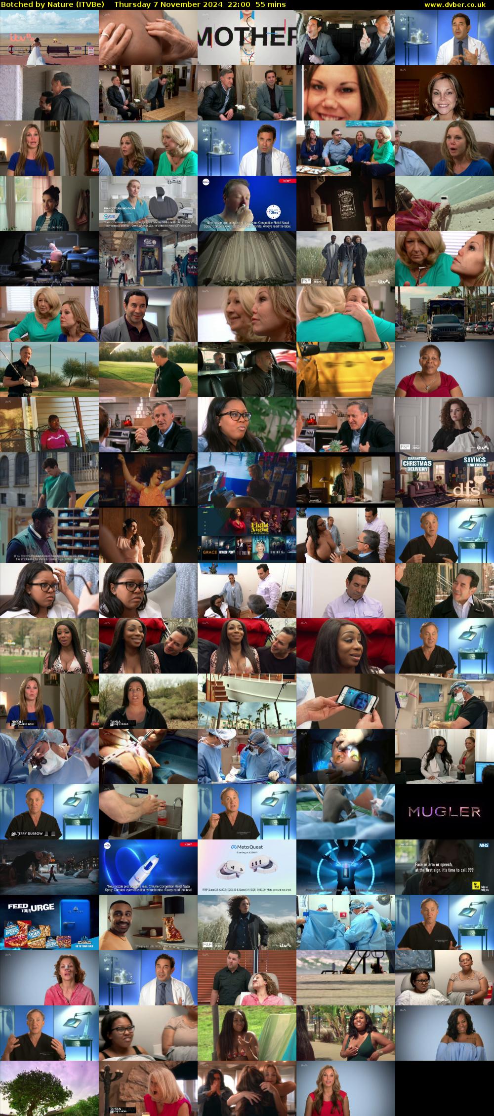 Botched by Nature (ITVBe) Thursday 7 November 2024 22:00 - 22:55