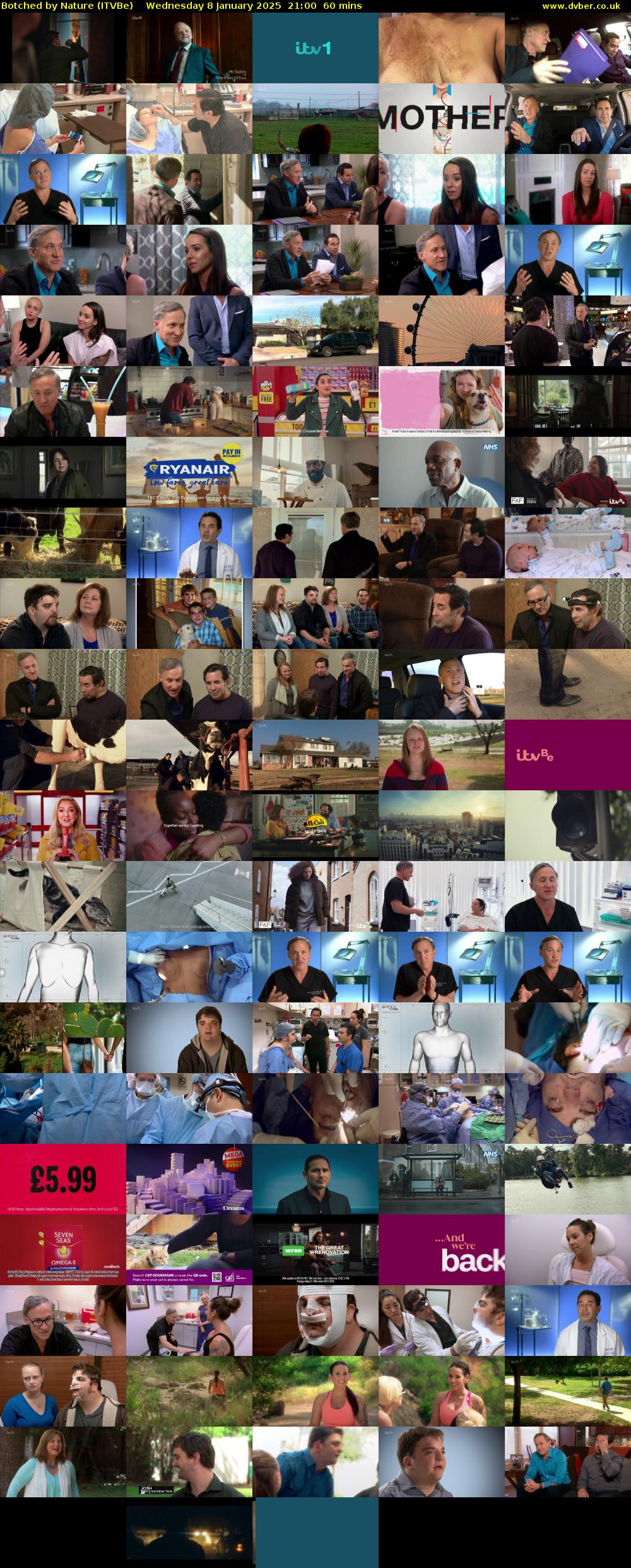 Botched by Nature (ITVBe) Wednesday 8 January 2025 21:00 - 22:00