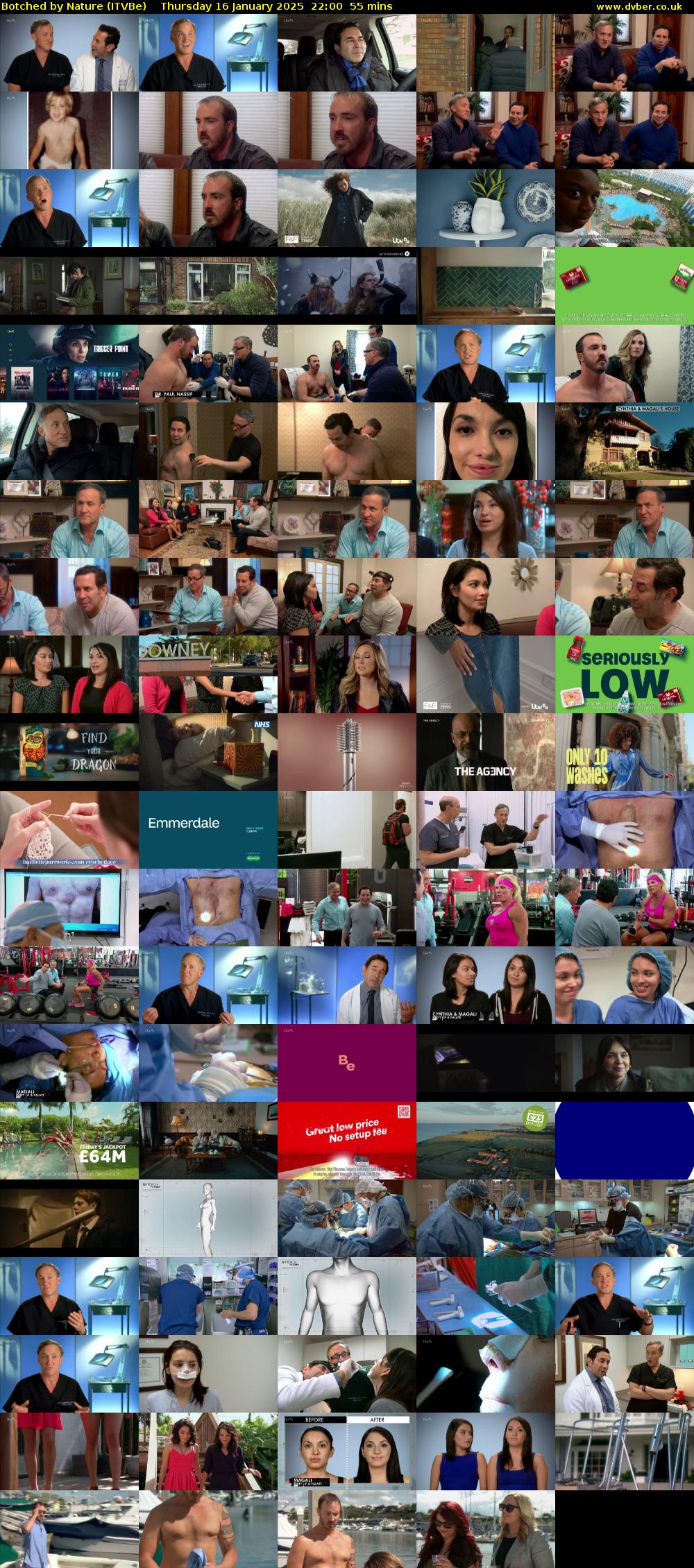Botched by Nature (ITVBe) Thursday 16 January 2025 22:00 - 22:55