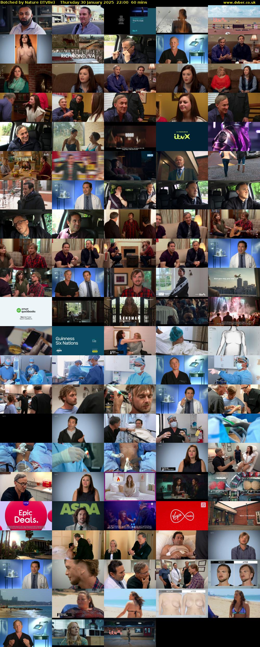 Botched by Nature (ITVBe) Thursday 30 January 2025 22:00 - 23:00