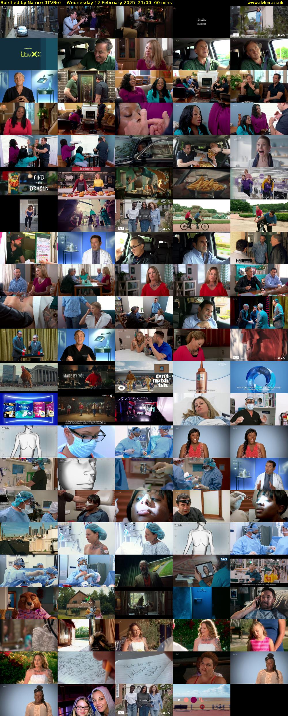 Botched by Nature (ITVBe) Wednesday 12 February 2025 21:00 - 22:00
