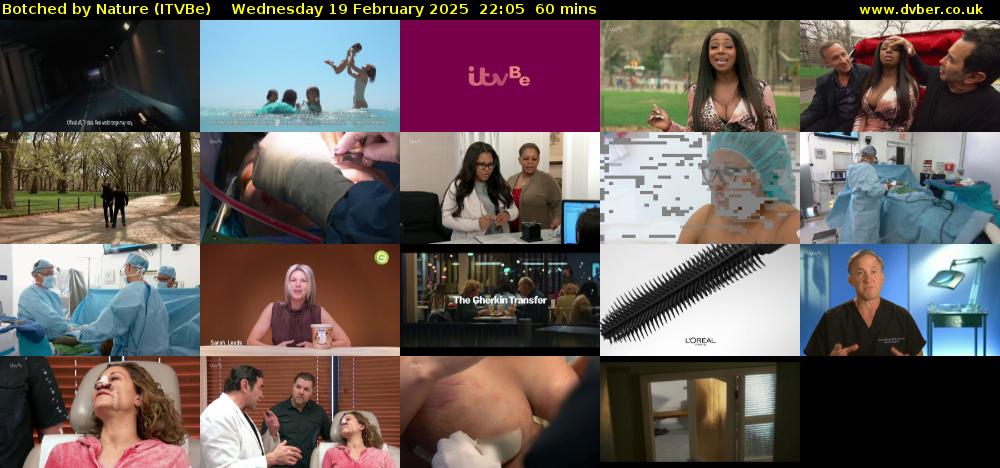 Botched by Nature (ITVBe) Wednesday 19 February 2025 22:05 - 23:05