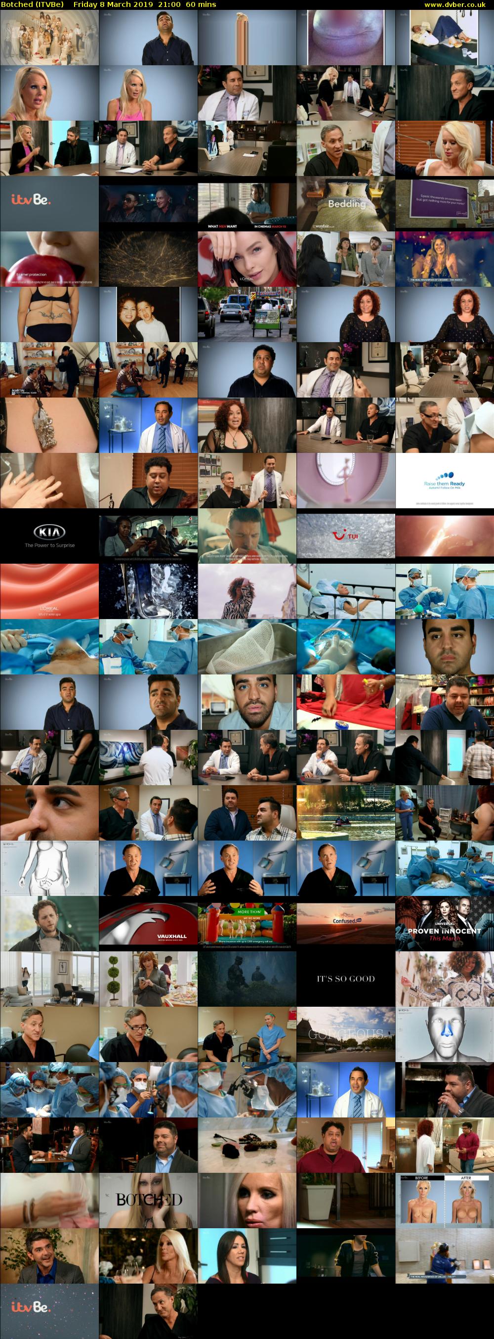 Botched (ITVBe) Friday 8 March 2019 21:00 - 22:00