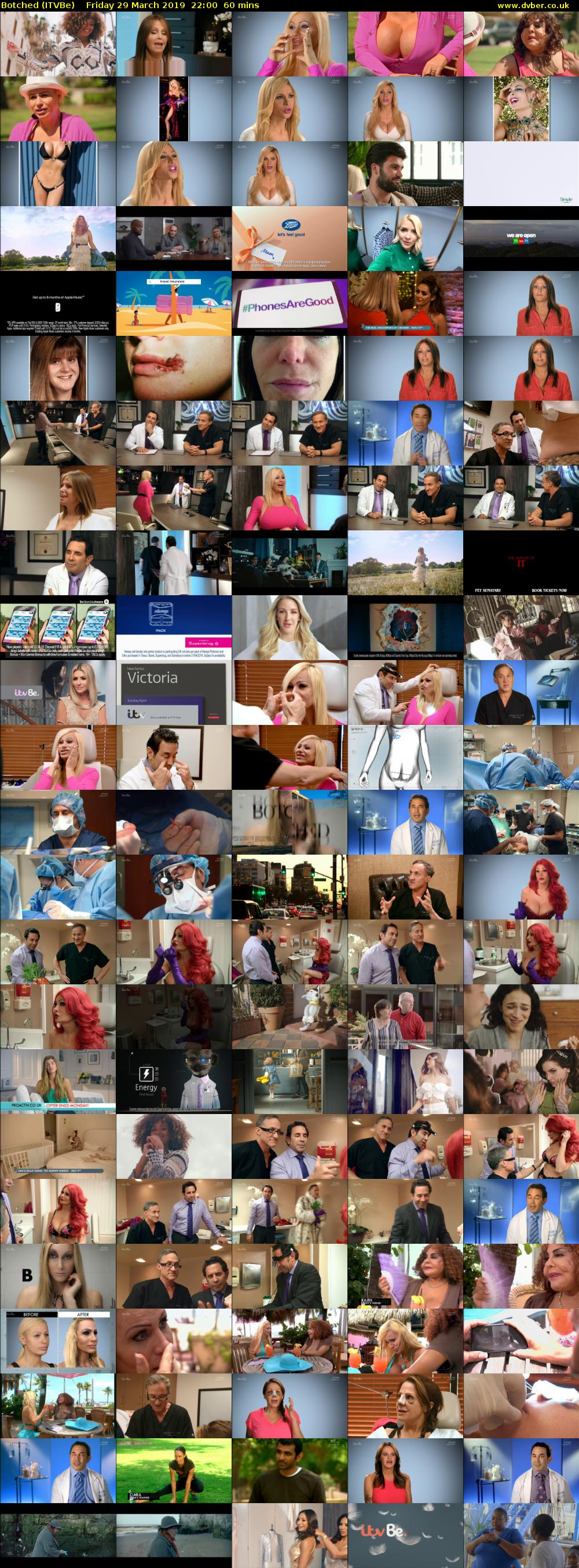 Botched (ITVBe) Friday 29 March 2019 22:00 - 23:00