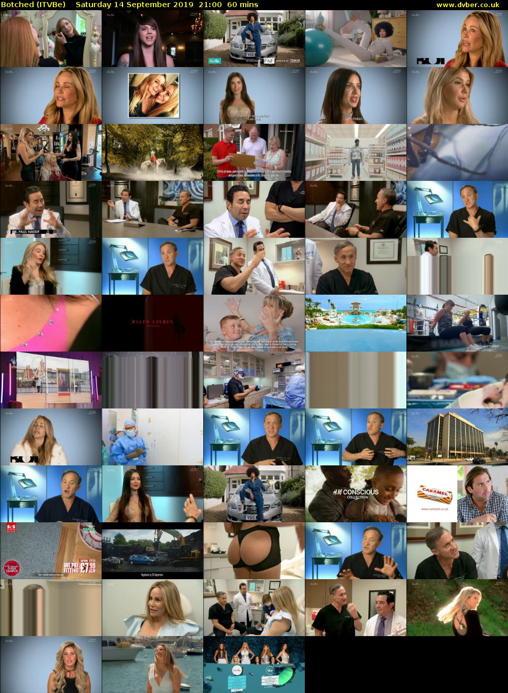 Botched (ITVBe) Saturday 14 September 2019 21:00 - 22:00