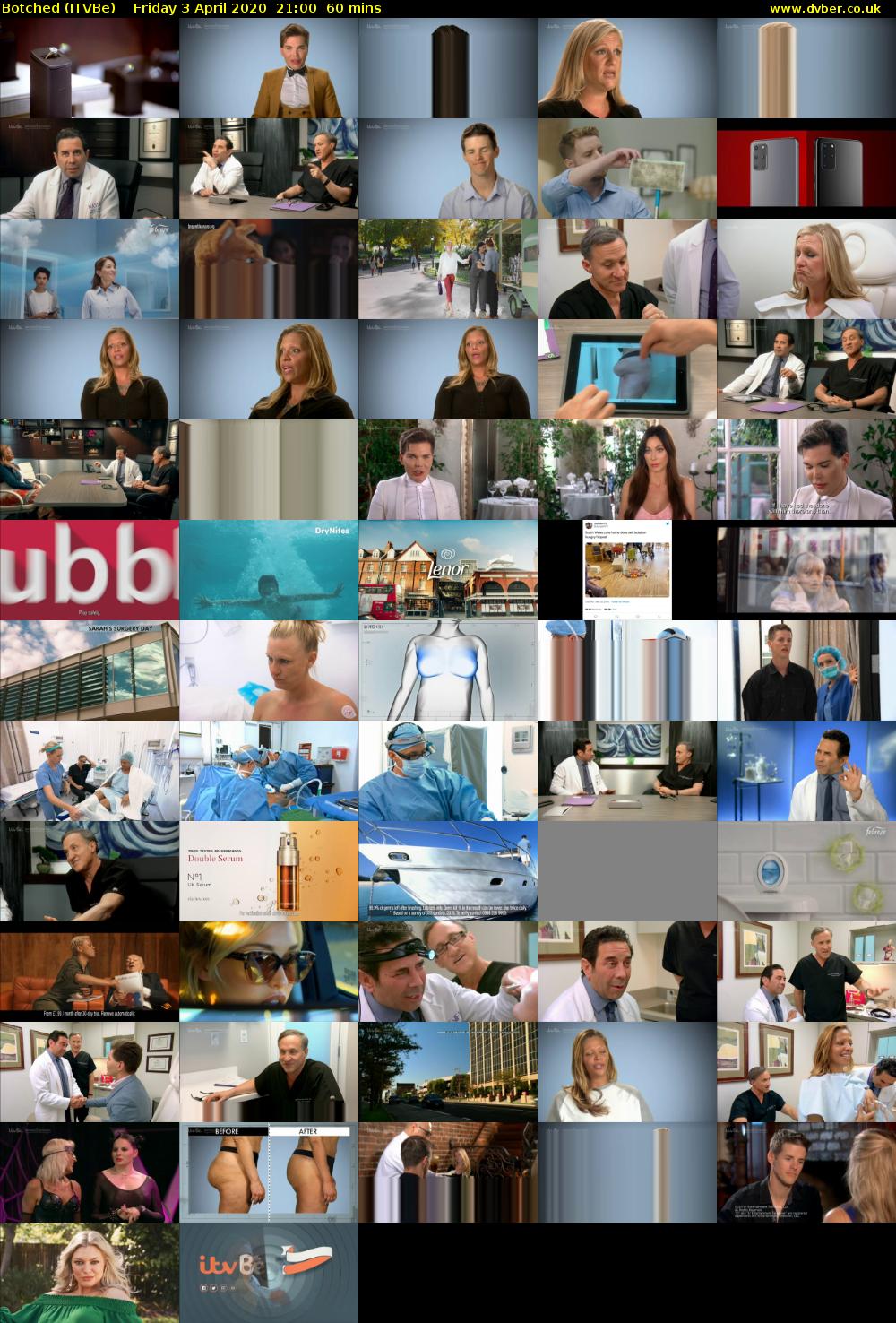 Botched (ITVBe) Friday 3 April 2020 21:00 - 22:00