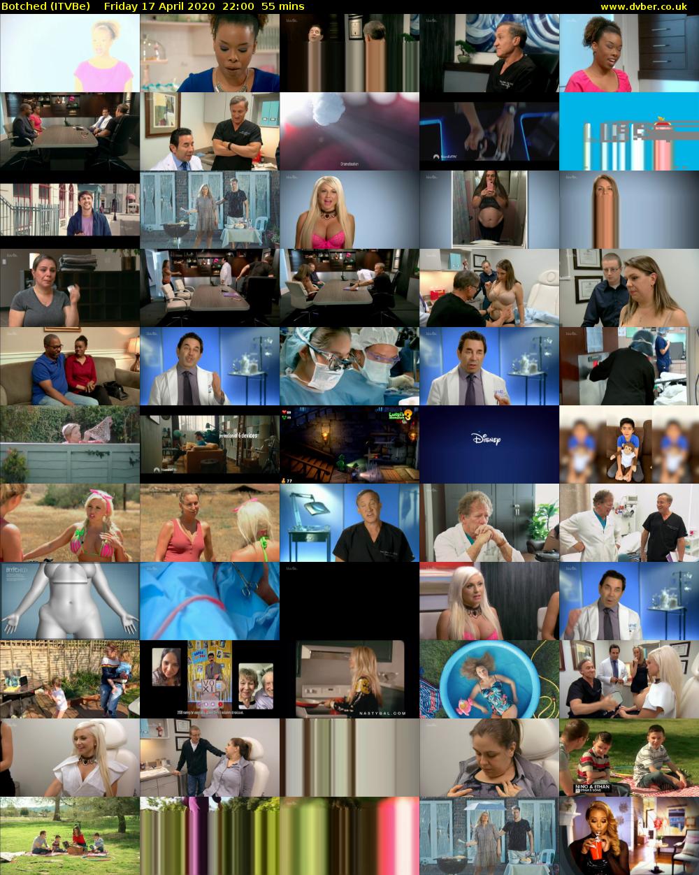 Botched (ITVBe) Friday 17 April 2020 22:00 - 22:55